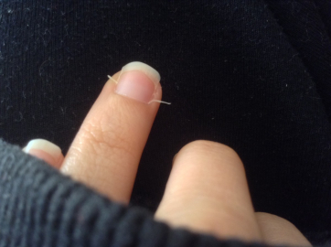 Şeytantırnağı nedir? Şeytantırnağı neden olur?