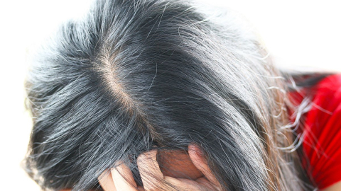 Patates kabuklarıyla beyaz saçlara son