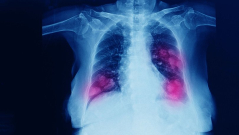 Yeni salgında artış