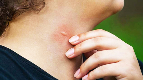 Yunanistan’da Batı Nil Virüsü vakaları artıyor