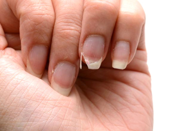 Tırnaklarınızı güçlendirmek için yöntemler