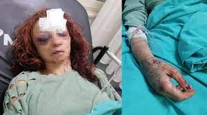 Erkek arkadaşı öldüresiye dövdü! Durumu ciddiyetini koruyor