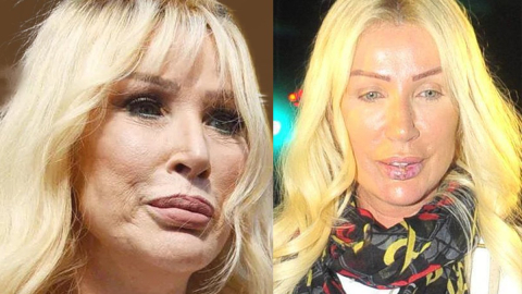 Seda Sayan'a 'estetiği bırak' tepkisi