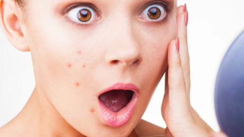 İşte sivilceleri anında yok eden o yöntem