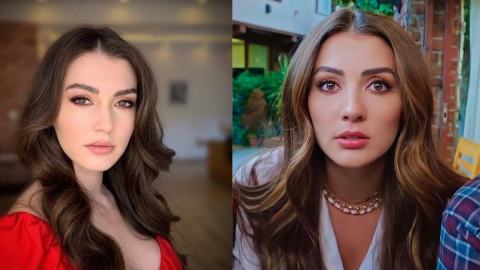 Burcu Özberk estetik harikası çıktı