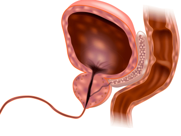 ‘UP Darlık’ Hastalığına Dikkat!