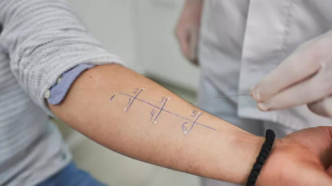 Alerji testi için hangi doktora gidilir? Alerji testi hangi bölüm bakar?