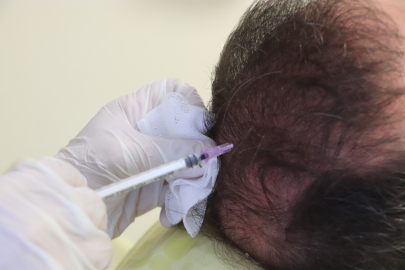 Sizde de saçkıran varsa bunları yapmayın!