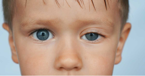 Doğumsal göz kapak düşüklüğüne ne yapabiliriz?