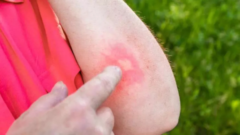 Akrep ve yılan ısırmalarına dikkat