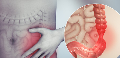 Hastalıkların sebebi stres olabilir mi?