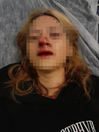 Kaldırım taşıyla kızın yüzünü parçaladı!