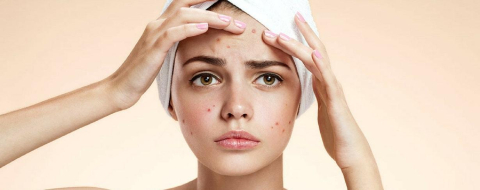 Yüzdeki sivilceler ne anlama geliyor?