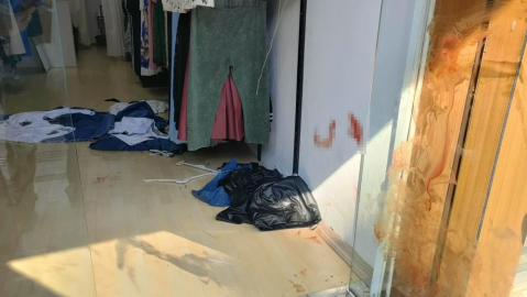 Bıçaklı saldırıya uğradı